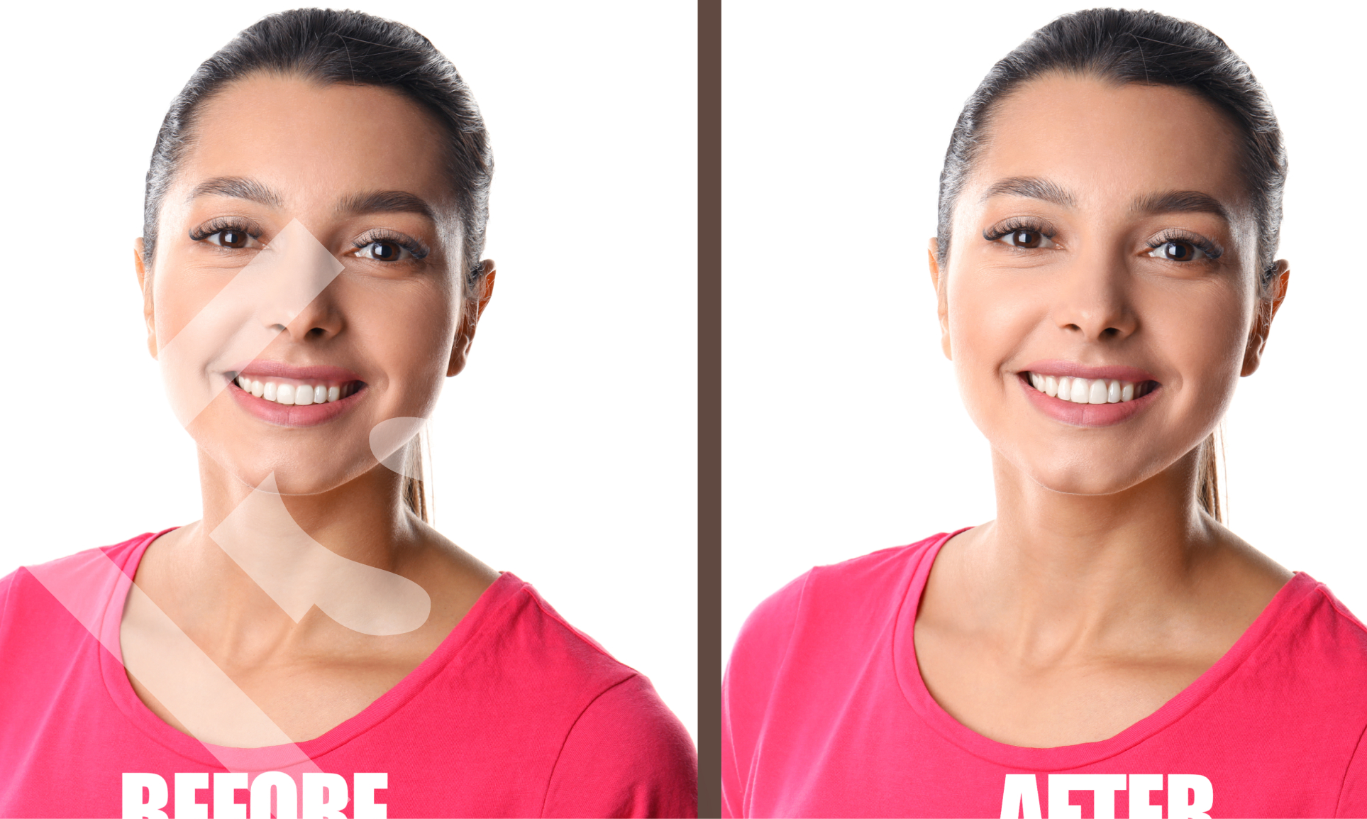 Sculpting Perfection: Experience the Perfecting Magic of Gum Contouring