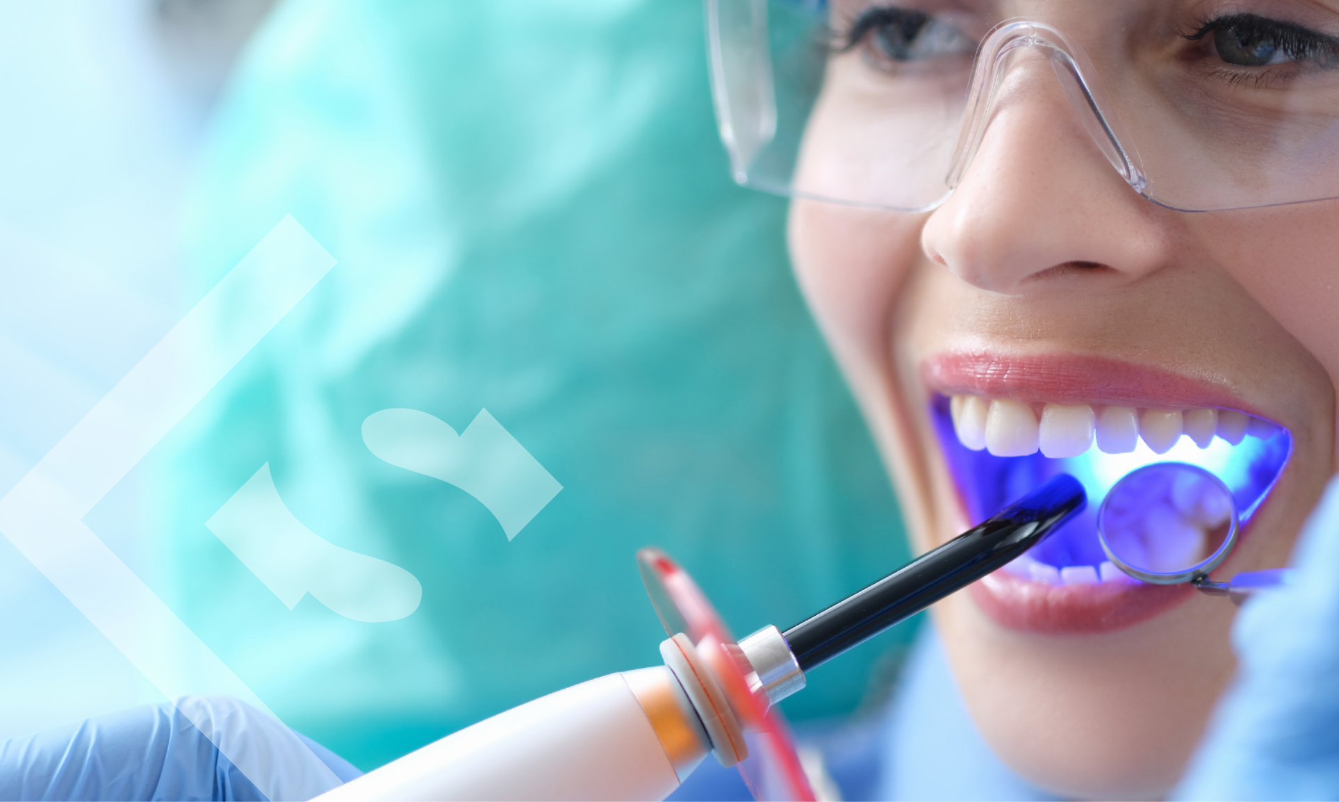 What Is Composite Bonding? Answers to Your 5 Frequently Asked Questions