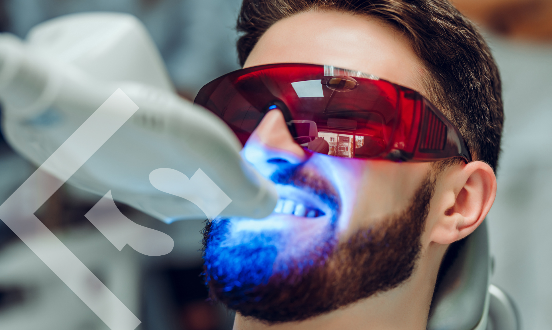 Brighten Your World: A Comprehensive Guide to Teeth Whitening