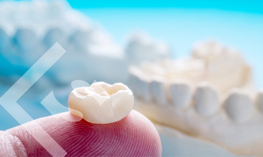 dental crowns