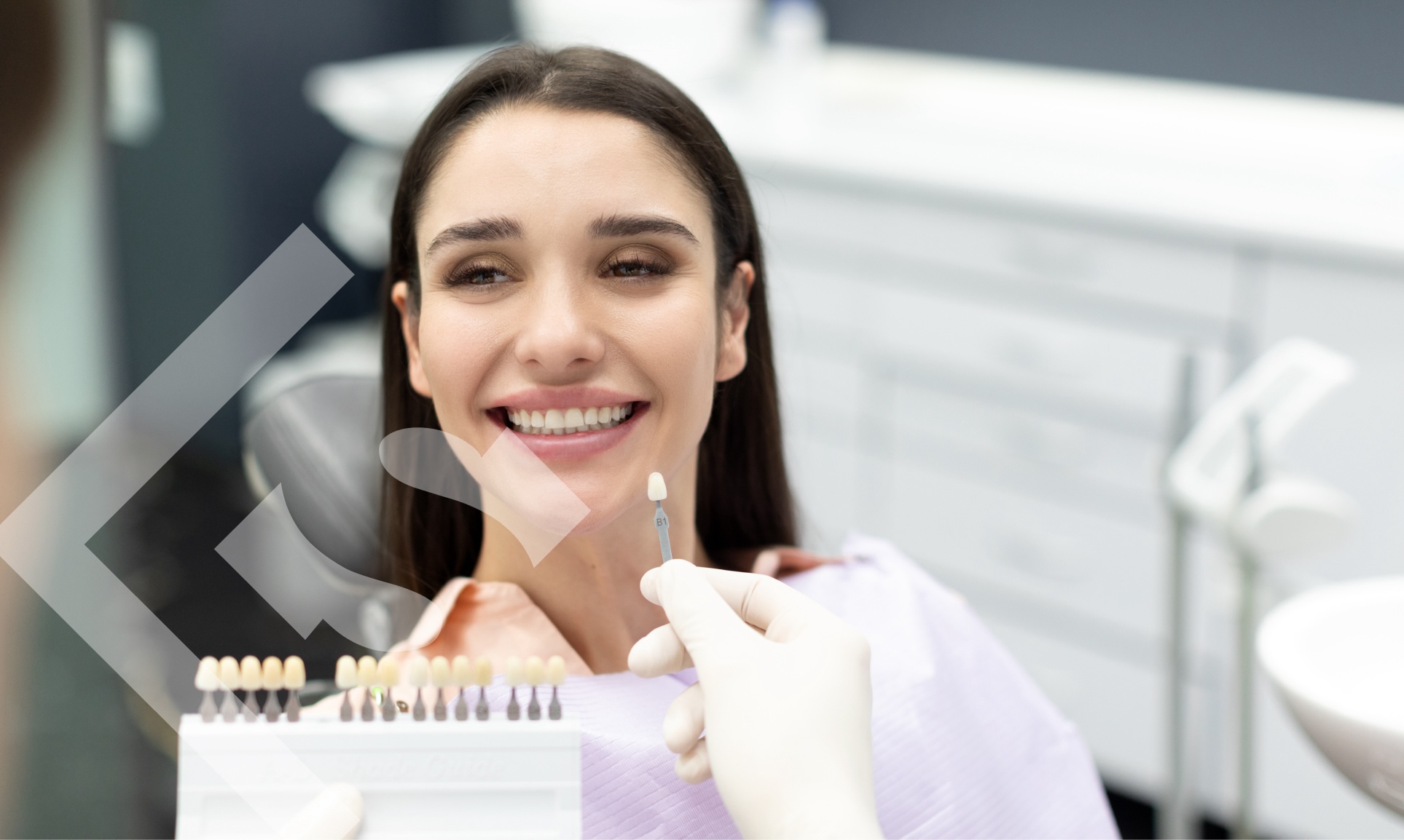 Are Veneers Right for You? Assessing Candidacy and Expectations