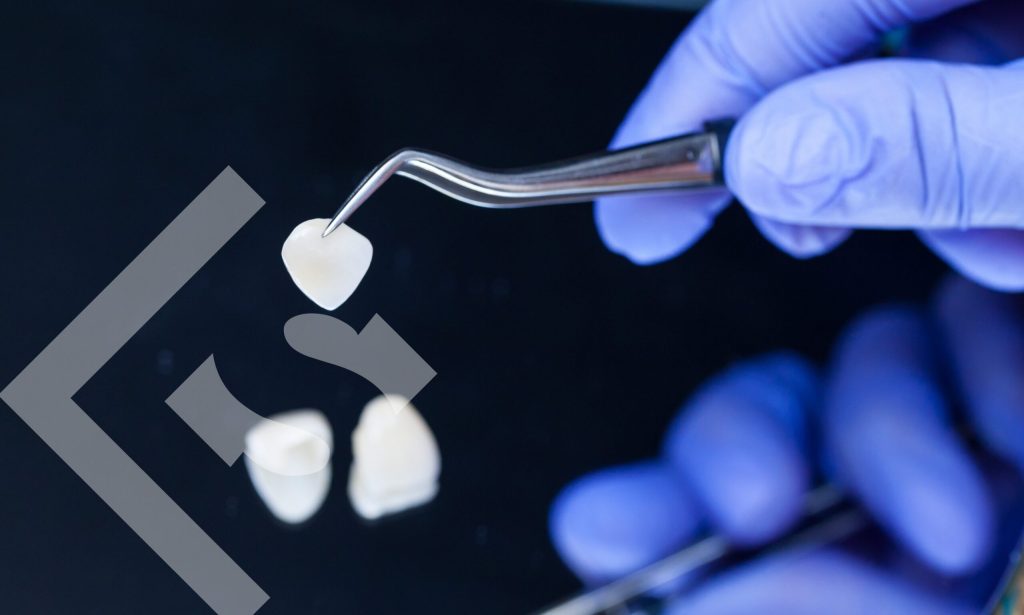 veneers can do more