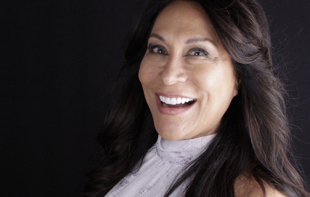 veneers10