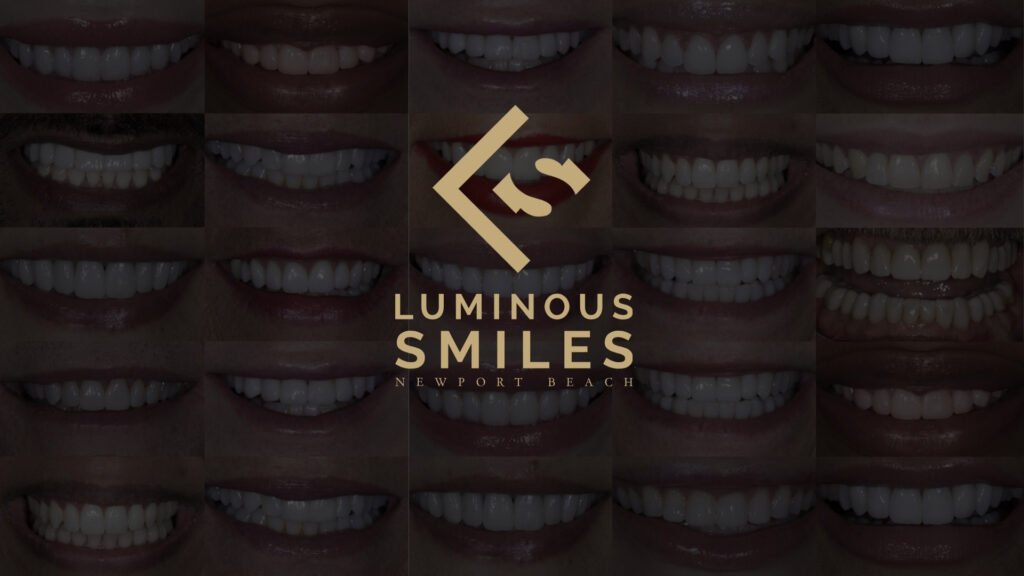AACD luxury dental care smile gallery - luminous smiles