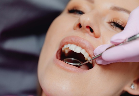 lum smiles composite bonding