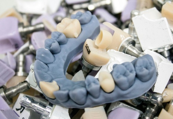lum smiles dental crowns