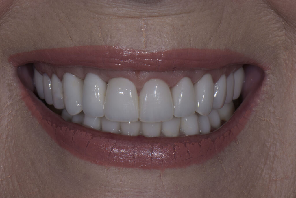 big gums cosmetic dentist near me