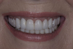 big gums cosmetic dentist near me
